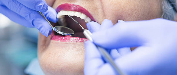 Best Knocked-Out Tooth Emergency  in Sughter, LA